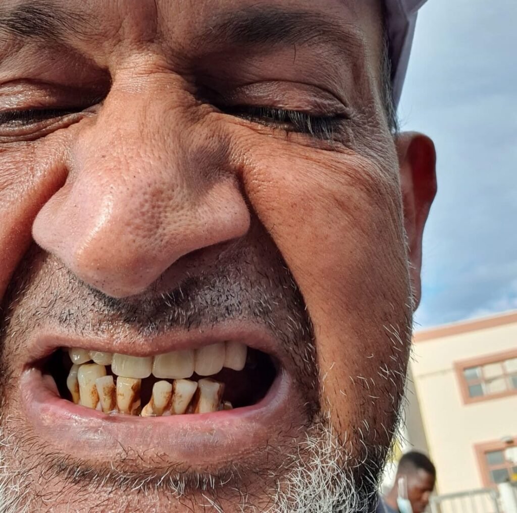 missing teeth